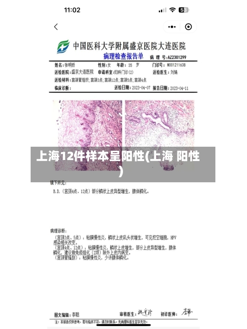 上海12件样本呈阳性(上海 阳性)-第2张图片