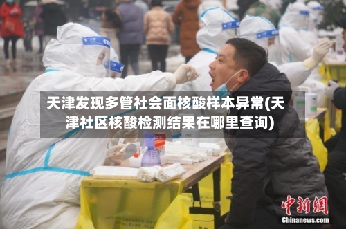 天津发现多管社会面核酸样本异常(天津社区核酸检测结果在哪里查询)