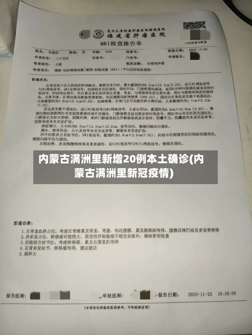 内蒙古满洲里新增20例本土确诊(内蒙古满洲里新冠疫情)-第3张图片